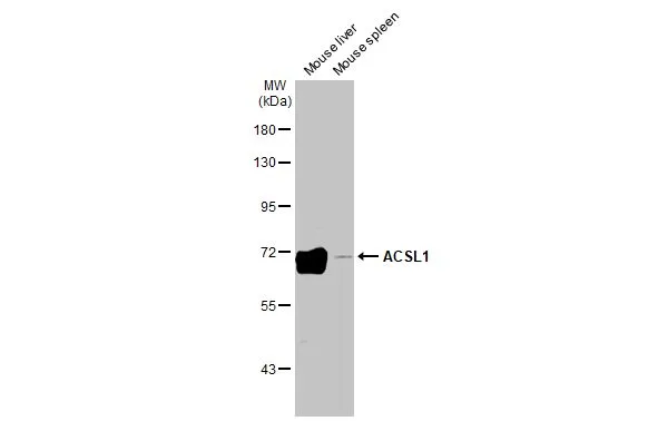 Various tissue extracts (50 μg) were separated by 7.5% SDS-PAGE, and the membrane was blotted with ACSL1 antibody [HL1651] (GTX637232) diluted at 1:1000. The HRP-conjugated anti-rabbit IgG antibody (GTX213110-01) was used to detect the primary antibody.