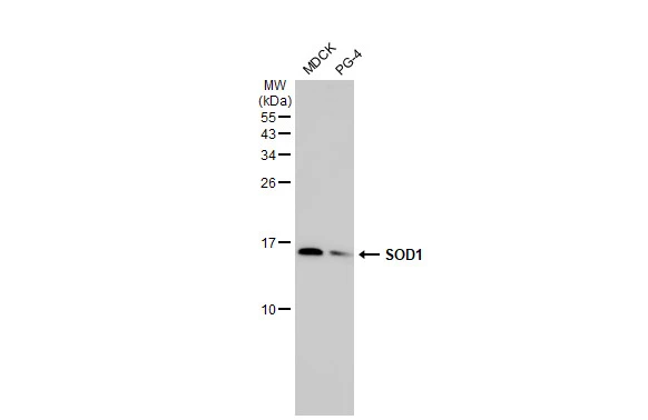 Various whole cell extracts (30 μg) were separated by 15% SDS-PAGE, and the membrane was blotted with SOD1 antibody [HL1653] (GTX637251) diluted at 1:1000. The HRP-conjugated anti-rabbit IgG antibody (GTX213110-01) was used to detect the primary antibody.