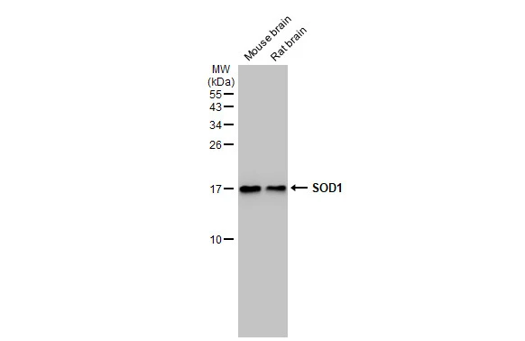 Various tissue extracts (50 μg) were separated by 15% SDS-PAGE, and the membrane was blotted with SOD1 antibody [HL1653] (GTX637251) diluted at 1:1000. The HRP-conjugated anti-rabbit IgG antibody (GTX213110-01) was used to detect the primary antibody.