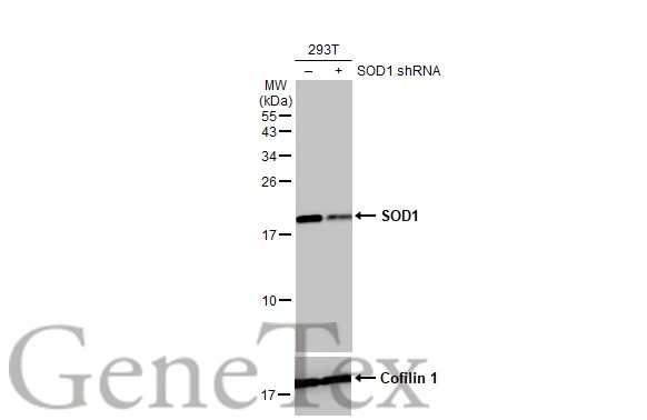 Non-transfected (–) and transfected (+) 293T whole cell extracts (30 μg) were separated by 15% SDS-PAGE, and the membrane was blotted with SOD1 antibody [HL1653] (GTX637251) diluted at 1:2000. The HRP-conjugated anti-rabbit IgG antibody (GTX213110-01) was used to detect the primary antibody.