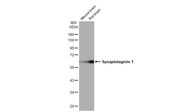 Various tissue extracts (50 μg) were separated by 10% SDS-PAGE, and the membrane was blotted with Synaptotagmin 1 antibody [HL1654] (GTX637252) diluted at 1:20000. The HRP-conjugated anti-rabbit IgG antibody (GTX213110-01) was used to detect the primary antibody.
