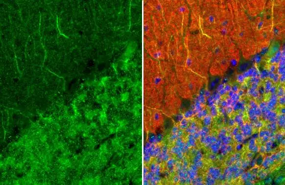 MAP2 antibody [HL1655] detects MAP2 protein by immunohistochemical analysis. Sample: Paraffin-embedded mouse cerebellum. Green: MAP2 stained by MAP2 antibody [HL1655] (GTX637253) diluted at 1:100. Red: beta Tubulin 3/ Tuj1, a Cytoskeleton marker, stained by beta Tubulin 3/ Tuj1 antibody [GT11710] (GTX631836) diluted at 1:500. Blue: Fluoroshield with DAPI (GTX30920). Antigen Retrieval: Citrate buffer, pH 6.0, 15 min