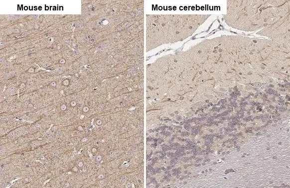 MAP2 antibody [HL1655]