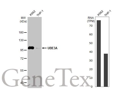 Various whole cell extracts (30 μg) were separated by 7.5% SDS-PAGE, and the membrane was blotted with UBE3A antibody [HL1660] (GTX637258) diluted at 1:1000. The HRP-conjugated anti-rabbit IgG antibody (GTX213110-01) was used to detect the primary antibody, and the signal was developed with Trident ECL plus-Enhanced. Corresponding RNA expression data for the same cell lines are based on Human Protein Atlas program.