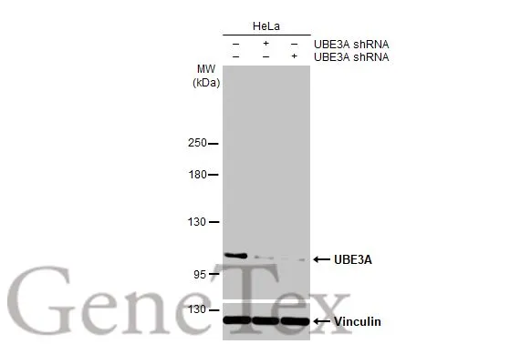Non-transfected (–) and transfected (+) HeLa whole cell extracts (30 μg) were separated by 5% SDS-PAGE, and the membrane was blotted with UBE3A antibody [HL1660] (GTX637258) diluted at 1:500. The HRP-conjugated anti-rabbit IgG antibody (GTX213110-01) was used to detect the primary antibody, and the signal was developed with Trident ECL plus-Enhanced.