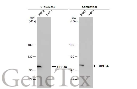 Various whole cell extracts (30 μg) were separated by 5% SDS-PAGE, and the membranes were blotted with UBE3A antibody [HL1660] (GTX637258) diluted at 1:1000 and competitor's antibody (Competitor) diluted at 1:1000. The HRP-conjugated anti-rabbit IgG antibody (GTX213110-01) was used to detect the primary antibody. *The competitor is not affiliated with GeneTex and does not endorse this product.