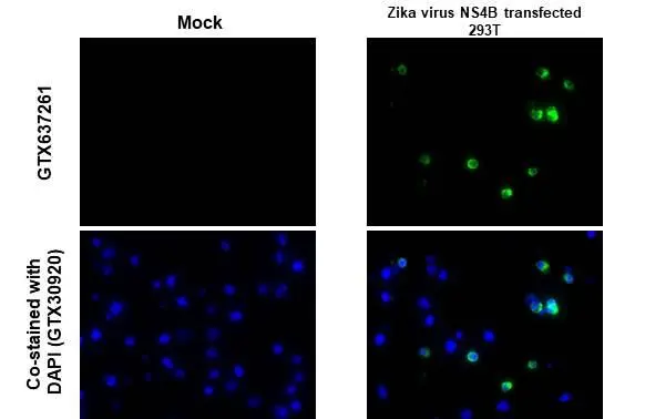 Zika virus NS4B protein antibody [HL1663]