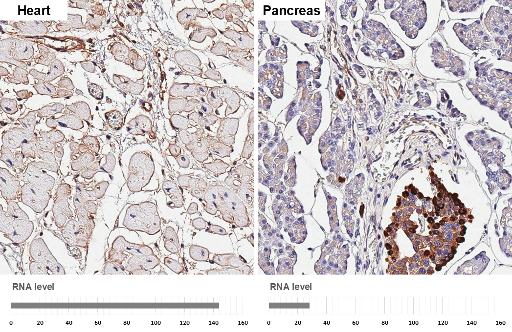 CD81 antibody [HL1667] detects CD81 protein by immunohistochemical analysis. Sample: Paraffin-embedded human tissues. CD81 stained by CD81 antibody [HL1667] (GTX637265) diluted at 1:200. Antigen Retrieval: Citrate buffer, pH 6.0, 15 min
