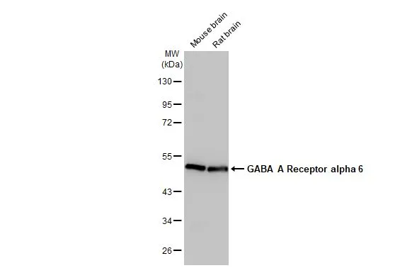 Various tissue extracts (50 μg) were separated by 10% SDS-PAGE, and the membrane was blotted with GABA A Receptor alpha 6 antibody [HL1669] (GTX637268) diluted at 1:1000. The HRP-conjugated anti-rabbit IgG antibody (GTX213110-01) was used to detect the primary antibody.