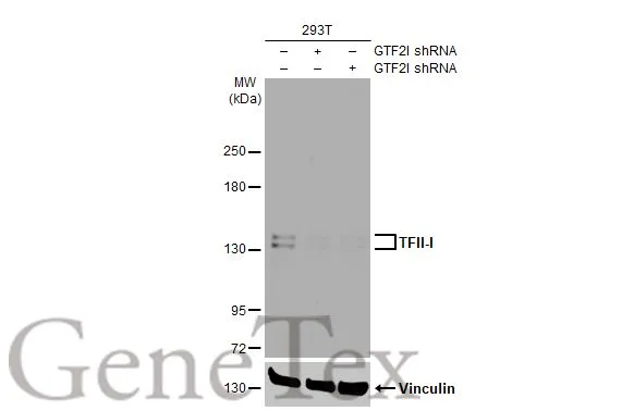 Non-transfected (–) and transfected (+) 293T whole cell extracts (30 μg) were separated by 5% SDS-PAGE, and the membrane was blotted with TFII-I antibody [HL1674] (GTX637273) diluted at 1:1000. The HRP-conjugated anti-rabbit IgG antibody (GTX213110-01) was used to detect the primary antibody, and the signal was developed with Trident ECL plus-Enhanced.