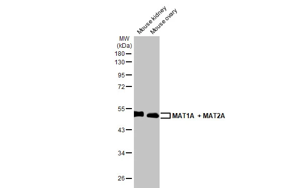 Various tissue extracts (50 μg) were separated by 10% SDS-PAGE, and the membrane was blotted with MAT1A + MAT2A antibody [HL1679] (GTX637278) diluted at 1:1000. The HRP-conjugated anti-rabbit IgG antibody (GTX213110-01) was used to detect the primary antibody.