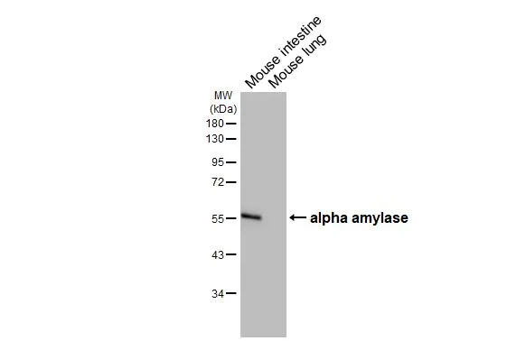 Various tissue extracts (50 μg) were separated by 10% SDS-PAGE, and the membrane was blotted with alpha Amylase antibody [HL1681] (GTX637280) diluted at 1:4000. The HRP-conjugated anti-rabbit IgG antibody (GTX213110-01) was used to detect the primary antibody.