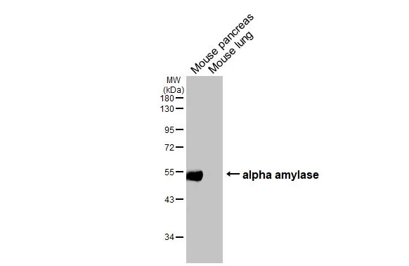 Various tissue extracts (50 μg) were separated by 10% SDS-PAGE, and the membrane was blotted with alpha Amylase antibody [HL1681] (GTX637280) diluted at 1:1000. The HRP-conjugated anti-rabbit IgG antibody (GTX213110-01) was used to detect the primary antibody.