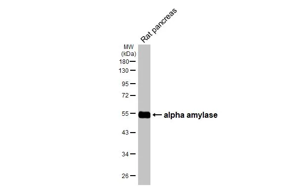 Rat tissue extract (50 μg) was separated by 10% SDS-PAGE, and the membrane was blotted with alpha Amylase antibody [HL1681] (GTX637280) diluted at 1:5000. The HRP-conjugated anti-rabbit IgG antibody (GTX213110-01) was used to detect the primary antibody.