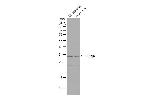 Various tissue extracts (50 μg) were separated by 12% SDS-PAGE, and the membrane was blotted with C1qA antibody [HL1695] (GTX637294) diluted at 1:1000. The HRP-conjugated anti-rabbit IgG antibody (GTX213110-01) was used to detect the primary antibody, and the signal was developed with Trident ECL plus-Enhanced.