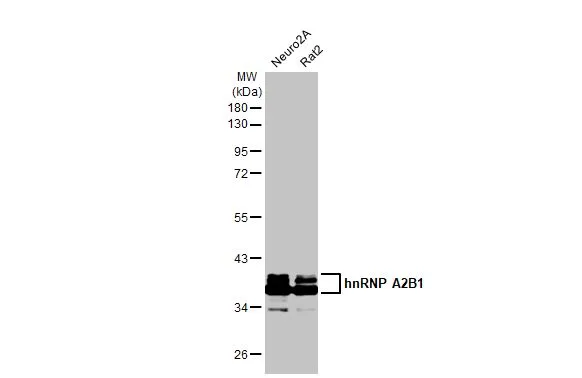 Various whole cell extracts (30 μg) were separated by 10% SDS-PAGE, and the membrane was blotted with hnRNP A2B1 antibody [HL1706] (GTX637305) diluted at 1:10000. The HRP-conjugated anti-rabbit IgG antibody (GTX213110-01) was used to detect the primary antibody.