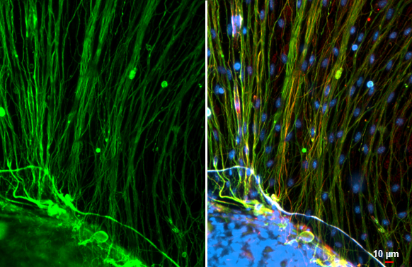 Anti-beta Tubulin 3/ Tuj1 antibody [HL1708] (GTX637307