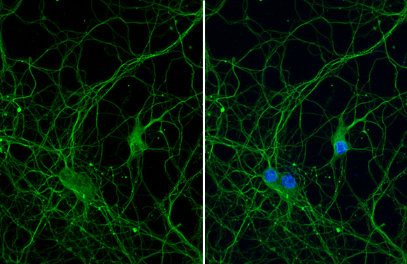 beta Tubulin 3/ Tuj1 antibody [HL1708] detects beta Tubulin 3/ Tuj1 protein at cytoskeleton by immunofluorescent analysis. Sample: DIV9 rat E18 primary hippocampal neuron cells were fixed in 4% paraformaldehyde at RT for 15 min. Green: beta Tubulin 3/ Tuj1 stained by beta Tubulin 3/ Tuj1 antibody [HL1708] (GTX637307) diluted at 1:250. Blue: Fluoroshield with DAPI (GTX30920).
