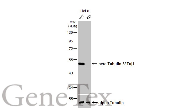 Anti-beta Tubulin 3/ Tuj1 antibody [HL1709] (GTX637308) | GeneTex