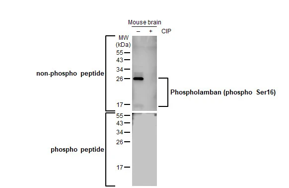 Untreated (–) and treated (+) Mouse tissue extract (50 μg) were separated by 15% SDS-PAGE, and the membrane was blotted with Phospholamban (phospho Ser16) antibody [HL1710] (GTX637309) diluted at 1:1000. The HRP-conjugated anti-rabbit IgG antibody (GTX213110-01) was used to detect the primary antibody.