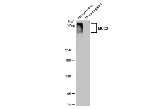 Various tissue extracts (50 μg) were separated by 5% SDS-PAGE, and the membrane was blotted with MUC2 antibody [HL1724] (GTX637372) diluted at 1:5000. The HRP-conjugated anti-rabbit IgG antibody (GTX213110-01) was used to detect the primary antibody.