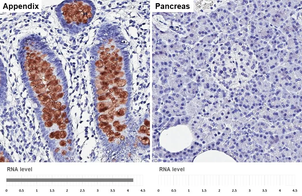 MUC2 antibody [HL1724] detects MUC2 protein by immunohistochemical analysis. Sample: Paraffin-embedded human tissues. MUC2 stained by MUC2 antibody [HL1724] (GTX637372) diluted at 1:4000. Antigen Retrieval: Citrate buffer, pH 6.0, 15 min