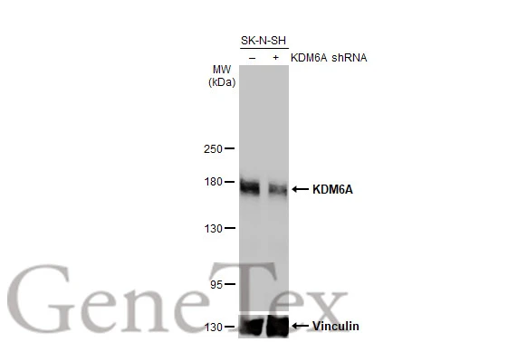 Non-transfected (–) and transfected (+) SK-N-SH whole cell extracts (30 μg) were separated by 5% SDS-PAGE, and the membrane was blotted with KDM6A antibody [HL1731] (GTX637379) diluted at 1:1000. The HRP-conjugated anti-rabbit IgG antibody (GTX213110-01) was used to detect the primary antibody.