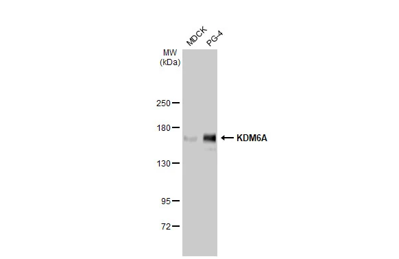 Various whole cell extracts (30 μg) were separated by 5% SDS-PAGE, and the membrane was blotted with KDM6A antibody [HL1731] (GTX637379) diluted at 1:1000. The HRP-conjugated anti-rabbit IgG antibody (GTX213110-01) was used to detect the primary antibody.