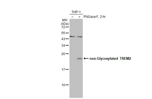 Untreated (–) and treated (+) THP-1 whole cell extracts (30 μg) were separated by 12% SDS-PAGE, and the membrane was blotted with TREM2 antibody [HL1739] (GTX637387) diluted at 1:250. The HRP-conjugated anti-rabbit IgG antibody (GTX213110-01) was used to detect the primary antibody, and the signal was developed with Trident ECL plus-Enhanced.