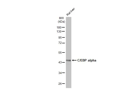 Rat tissue extract (50 μg) was separated by 10% SDS-PAGE, and the membrane was blotted with C/EBP alpha antibody [HL1747] (GTX637397) diluted at 1:1000. The HRP-conjugated anti-rabbit IgG antibody (GTX213110-01) was used to detect the primary antibody, and the signal was developed with Trident femto Western HRP Substrate.