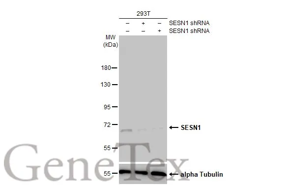 Non-transfected (–) and transfected (+) 293T whole cell extracts (30 μg) were separated by 7.5% SDS-PAGE, and the membrane was blotted with SESN1 antibody [HL1750] (GTX637400) diluted at 1:2000. The HRP-conjugated anti-rabbit IgG antibody (GTX213110-01) was used to detect the primary antibody, and the signal was developed with Trident ECL plus-Enhanced.
