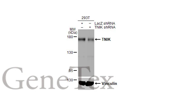 Non-transfected (–) and transfected (+) 293T whole cell extracts (30 μg) were separated by 5% SDS-PAGE, and the membrane was blotted with TNIK antibody [HL1751] (GTX637401) diluted at 1:10000. The HRP-conjugated anti-rabbit IgG antibody (GTX213110-01) was used to detect the primary antibody, and the signal was developed with Trident ECL plus-Enhanced.
