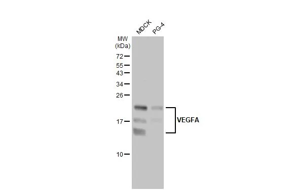 Various whole cell extracts (30 μg) were separated by 15% SDS-PAGE, and the membrane was blotted with VEGFA antibody [HL1755] (GTX637405) diluted at 1:1000. The HRP-conjugated anti-rabbit IgG antibody (GTX213110-01) was used to detect the primary antibody, and the signal was developed with Trident ECL plus-Enhanced.