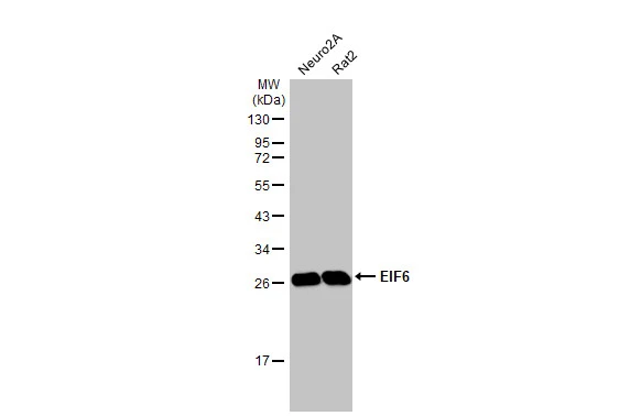 Various whole cell extracts (50 μg) were separated by 12% SDS-PAGE, and the membrane was blotted with EIF6 antibody [HL1759] (GTX637409) diluted at 1:1000. The HRP-conjugated anti-rabbit IgG antibody (GTX213110-01) was used to detect the primary antibody.