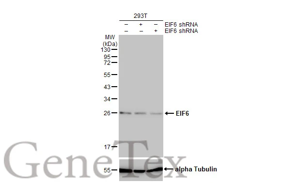 Non-transfected (–) and transfected (+) 293T whole cell extracts (30 μg) were separated by 12% SDS-PAGE, and the membrane was blotted with EIF6 antibody [HL1759] (GTX637409) diluted at 1:5000. The HRP-conjugated anti-rabbit IgG antibody (GTX213110-01) was used to detect the primary antibody.