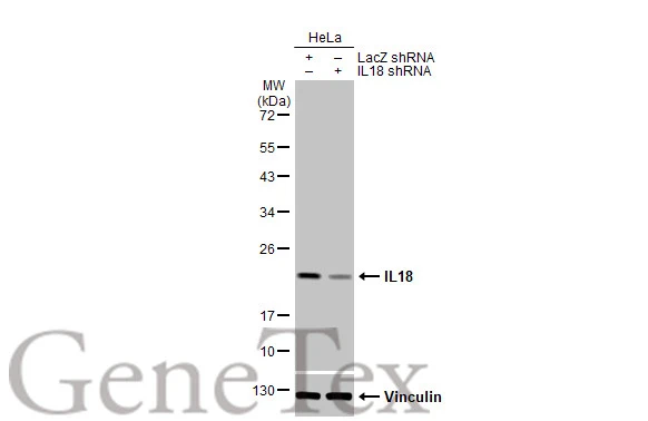 Non-transfected (–) and transfected (+) HeLa whole cell extracts (30 μg) were separated by 12% SDS-PAGE, and the membrane was blotted with IL18 antibody [HL1761] (GTX637411) diluted at 1:5000. The HRP-conjugated anti-rabbit IgG antibody (GTX213110-01) was used to detect the primary antibody, and the signal was developed with Trident ECL plus-Enhanced.