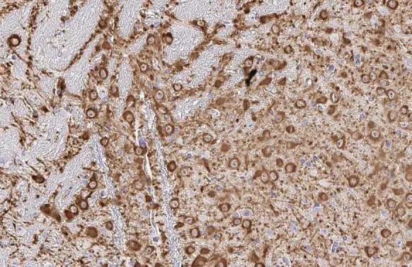 Tyrosine Hydroxylase antibody [HL1762] detects Tyrosine Hydroxylase protein at cytoplasm by immunohistochemical analysis. Sample: Paraffin-embedded mouse midbrain. Tyrosine Hydroxylase stained by Tyrosine Hydroxylase antibody [HL1762] (GTX637412) diluted at 1:100. Antigen Retrieval: Citrate buffer, pH 6.0, 15 min