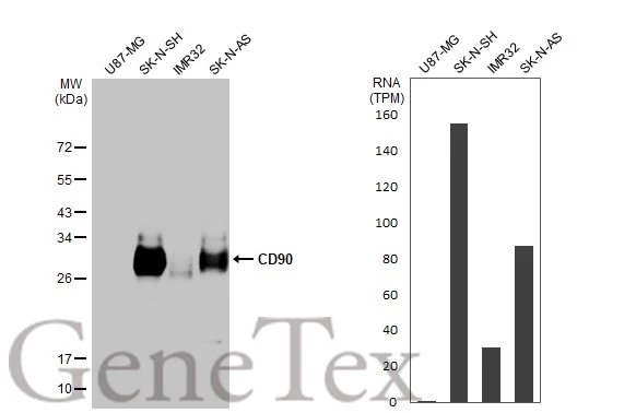 Various whole cell extracts (30 μg) were separated by 12% SDS-PAGE, and the membrane was blotted with CD90 antibody [HL1766] (GTX637416) diluted at 1:1000. The HRP-conjugated anti-rabbit IgG antibody (GTX213110-01) was used to detect the primary antibody. Corresponding RNA expression data for the same cell lines are based on Human Protein Atlas program.
