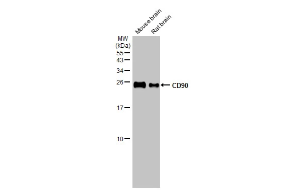 Various tissue extracts (50 μg) were separated by 15% SDS-PAGE, and the membrane was blotted with CD90 antibody [HL1766] (GTX637416) diluted at 1:1000. The HRP-conjugated anti-rabbit IgG antibody (GTX213110-01) was used to detect the primary antibody.