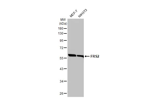 Various whole cell extracts (30 μg) were separated by 10% SDS-PAGE, and the membrane was blotted with FRS2 antibody [HL1774] (GTX637426) diluted at 1:5000. The HRP-conjugated anti-rabbit IgG antibody (GTX213110-01) was used to detect the primary antibody.