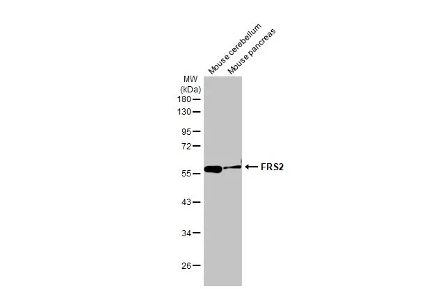 Various tissue extracts (50 μg) were separated by 10% SDS-PAGE, and the membrane was blotted with FRS2 antibody [HL1774] (GTX637426) diluted at 1:5000. The HRP-conjugated anti-rabbit IgG antibody (GTX213110-01) was used to detect the primary antibody.