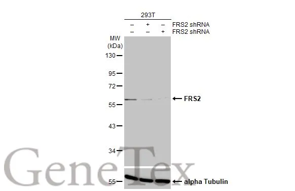 Non-transfected (–) and transfected (+) 293T whole cell extracts (30 μg) were separated by 10% SDS-PAGE, and the membrane was blotted with FRS2 antibody [HL1774] (GTX637426) diluted at 1:50000. The HRP-conjugated anti-rabbit IgG antibody (GTX213110-01) was used to detect the primary antibody.