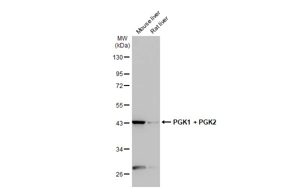 Various tissue extracts (50 μg) were separated by 10% SDS-PAGE, and the membrane was blotted with PGK1 + PGK2 antibody [HL1775] (GTX637427) diluted at 1:10000. The HRP-conjugated anti-rabbit IgG antibody (GTX213110-01) was used to detect the primary antibody.
