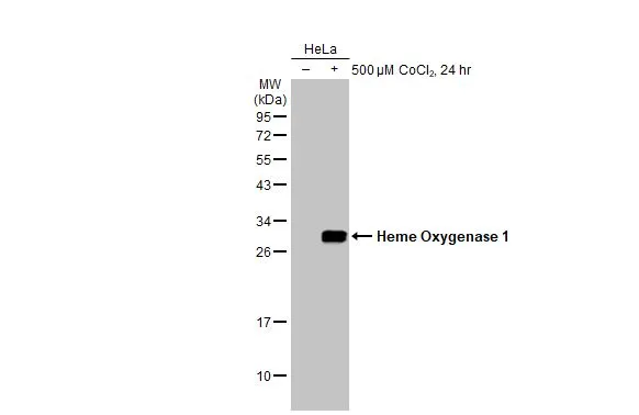 Untreated (–) and treated (+) HeLa whole cell extracts (30 μg) were separated by 12% SDS-PAGE, and the membrane was blotted with Heme Oxygenase 1 antibody [HL1780] (GTX637432) diluted at 1:1000. The HRP-conjugated anti-rabbit IgG antibody (GTX213110-01) was used to detect the primary antibody.