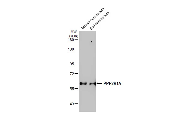 Various tissue extracts (50 μg) were separated by 7.5% SDS-PAGE, and the membrane was blotted with PPP2R1A antibody [HL1781] (GTX637433) diluted at 1:10000. The HRP-conjugated anti-rabbit IgG antibody (GTX213110-01) was used to detect the primary antibody, and the signal was developed with Trident ECL plus-Enhanced.
