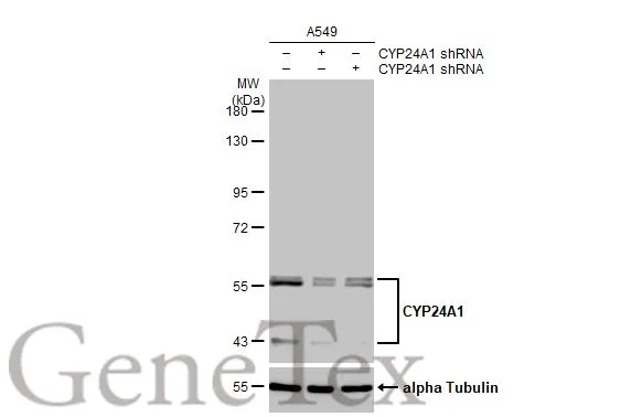 Non-transfected (–) and transfected (+) A549 whole cell extracts (30 μg) were separated by 7.5% SDS-PAGE, and the membrane was blotted with CYP24A1 antibody [HL1783] (GTX637435) diluted at 1:1000. The HRP-conjugated anti-rabbit IgG antibody (GTX213110-01) was used to detect the primary antibody, and the signal was developed with Trident ECL plus-Enhanced.