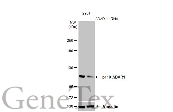 Non-transfected (–) and transfected (+) 293T whole cell extracts (30 μg) were separated by 5% SDS-PAGE, and the membrane was blotted with ADAR1 antibody [HL1789] (GTX637441) diluted at 1:5000. The HRP-conjugated anti-rabbit IgG antibody (GTX213110-01) was used to detect the primary antibody.