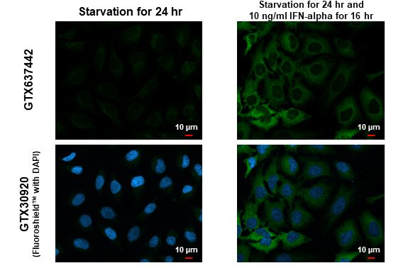 MX1 antibody [HL1790] detects MX1 protein at cytoplasm by immunofluorescent analysis. Sample: Mock and treated HeLa cells were fixed in 4% paraformaldehyde at RT for 15 min. Green: MX1 stained by MX1 antibody [HL1790] (GTX637442) diluted at 1:500. Blue: Fluoroshield with DAPI (GTX30920).