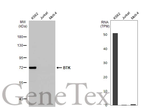 BTK antibody [HL1803]