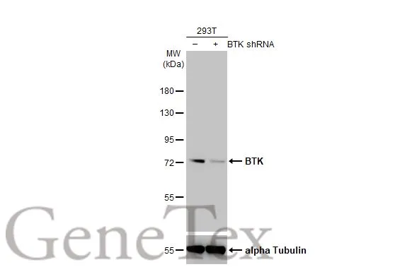 BTK antibody [HL1803]